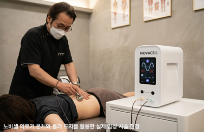 노바셀 의료기 본체와 롤러 도자를 활용한 실제 임상 시술 현장
